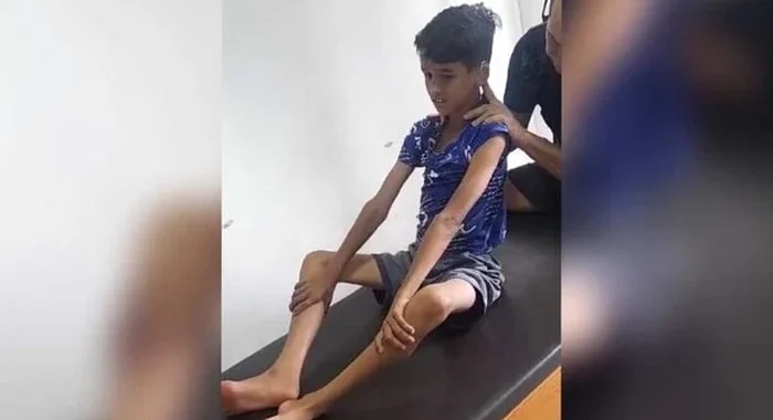 Criança sente dor 24h e mãe faz apelo: “Preciso levá-lo a Brasília”