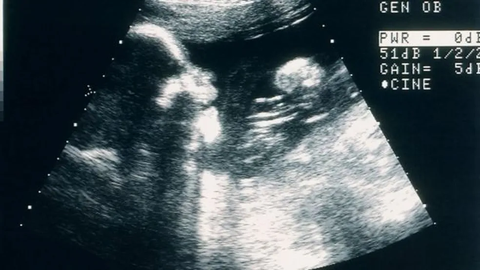 Perda gestacional: mães falam sobre falta de privacidade e de apoio nos hospitais quando ocorre aborto espontâneo